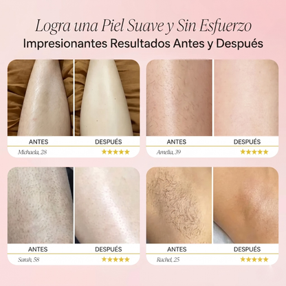 Eloranza™ Depiladora Pro