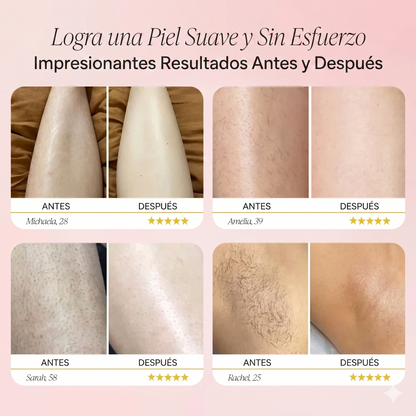 Eloranza™ Depiladora Pro